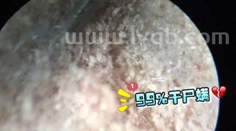 床上怎么去螨虫,床上的螨虫怎么样彻底清除掉