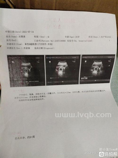 保胎针多少钱一针,打孕酮针痛吗