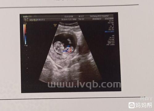 NT三个亮点是男孩女孩,nt可以看出是男孩还是女孩吗(3个亮点是男孩)