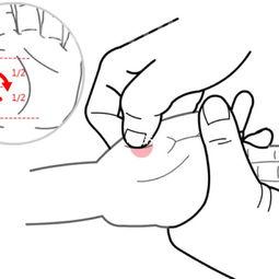 小儿积食的推拿手法如何查看小孩积食按摩法图解