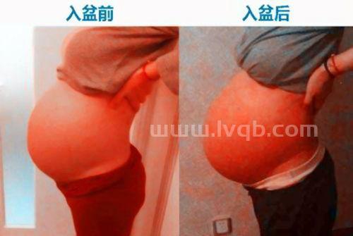 胎儿入盆是什么感觉,如何知道胎儿入盆是什么感觉