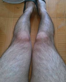 汗毛怎么永久去除,怎样或什么东西能永远的去掉身体上的体毛?