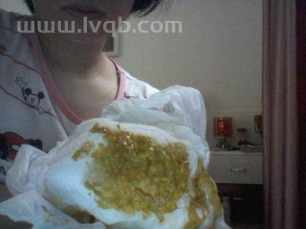 婴儿拉稀怎么回事,宝宝经常拉肚子是怎么回事