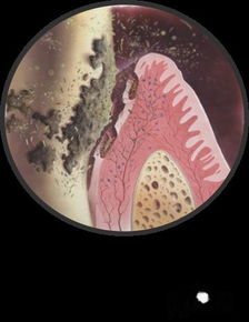 智齿的作用,智齿有什么作用?你有哪些了解?