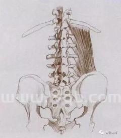 腰椎弯曲怎么矫正,腰椎弯曲怎么自我矫正?