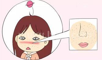 角质层薄怎么办皮肤角质层特别薄怎么办